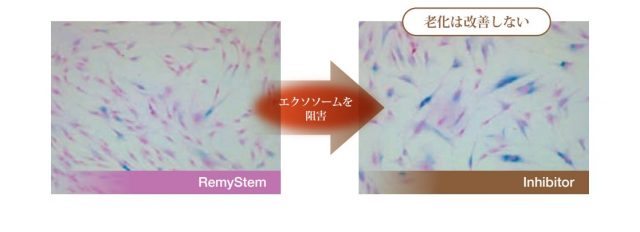 エクソソーム